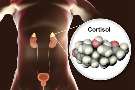 Cortisolu