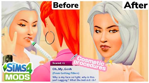 Cosmetic procedures mod sims 4. The Sims 4 Career: Medical career-Cardiology, Pediatrics, Plastic Surgery, and Dermatology DOWNLOAD ***Note- Amongst my millions of edits, I accidentally uploaded the wrong file last night. The correct one is up! Sorry for the inconvenience. xoxo Success in the medical field is only found by the most intelligent, ambitious sims. Medical school is filled with studying and no pay, Residency has ... 