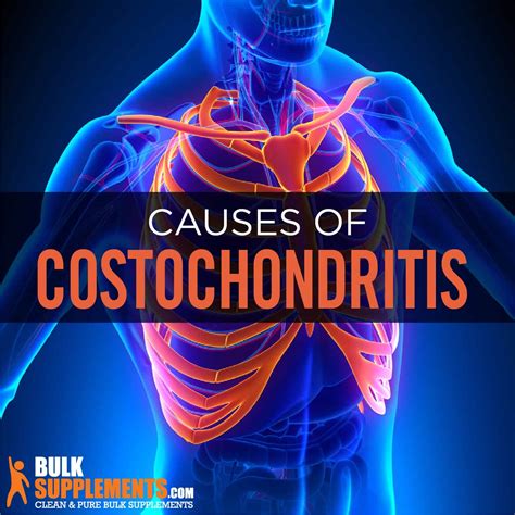 Costochondritis: Pain Locations, Causes, Treatment, Symptoms …