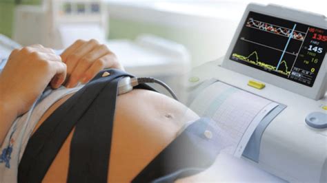 Costos y beneficios del monitoreo fetal electrónico. - Dixtuor pour instruments à vent [par] claude arrieu..