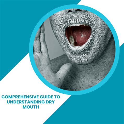 Cotton Mouth: A Comprehensive Guide to Understanding and Overcoming Dry Mouth