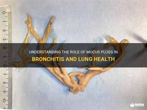 Coughing up bronchial plugs.  Not too bad now (touch wood).  Reply repl...