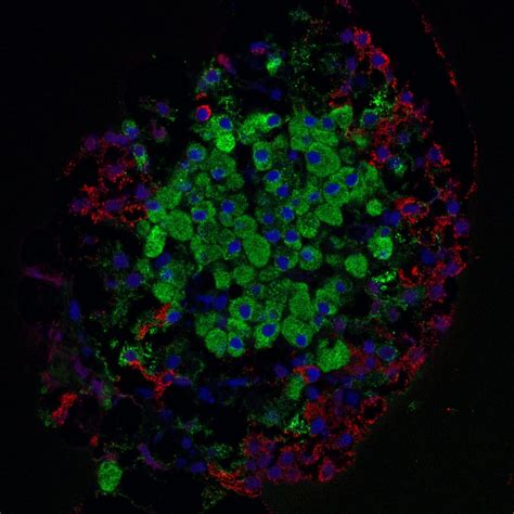 Could Beta Cell Age and Differentiation Play a Role in the Development