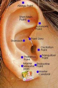 Could I lose weight by getting my ear stapled?