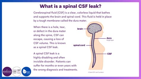 Could this be a CSF leak? - Neurology - MedHelp