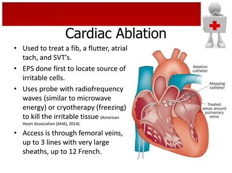 Help Please W/EP Studies. 1. Ablation codes have the EP Study bundled (or part of ) into the codes. 2. Ablation of SVT is 93653. Ablation of VT is 93654, Ablationof pulmonary vein isolation (A-Fib Ablation) is coded 93656. The... [ Read More ] CPT 33274 Micra pacemaker followed by AV junction ablation.. 