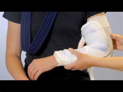 Cpt code for long arm cast application.  Bill an Initial E/M service co...