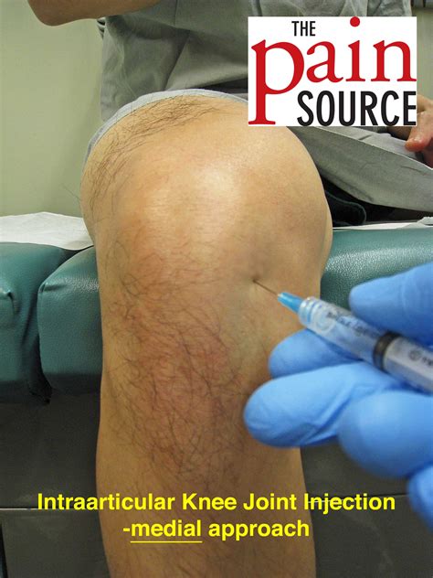 Cpt for knee injection. Things To Know About Cpt for knee injection. 