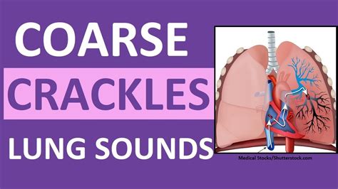 Crackling noise in lungs when breathing