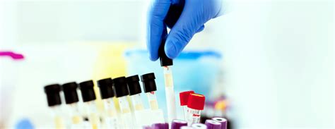 Creatinine blood test - UCSF Health