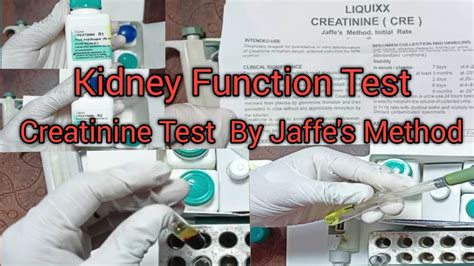 Creatinine test procedure Kidney Function Test . YouTube
