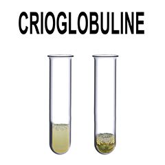 Crioglobuline: cosa sono, accertamenti e trattamenti