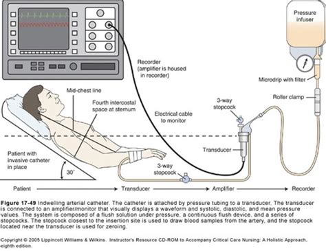 Critical Care: Hemodynamic Monitoring Flashcards Quizlet