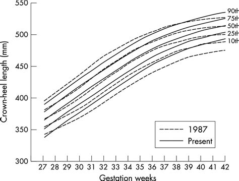 Crown-heel length definition of crown-heel length by …