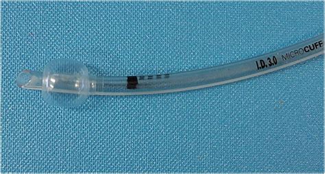 Cuffed endotracheal tubes for neonates and young infants: a