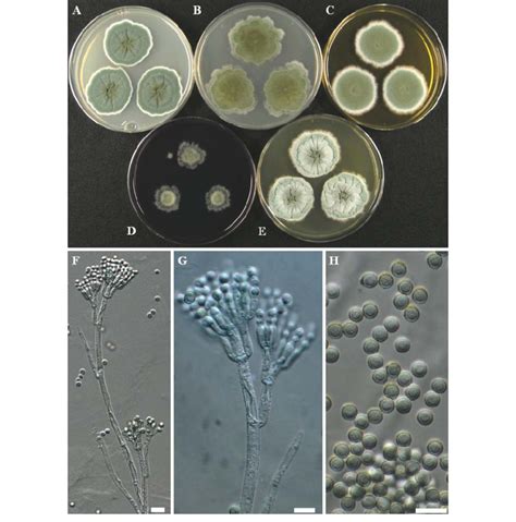 Cultural and morphological characteristics of Penicillium sp. 1 ...