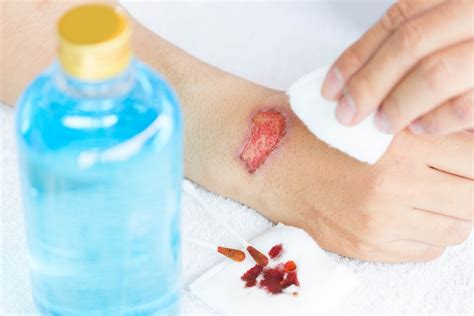 Cure wounds. A skin wound that doesn't heal, heals slowly or heals but tends to recur is known as a chronic wound. Some of the many causes of chronic (ongoing) skin wounds can include trauma, burns, skin cancers, infection or underlying medical conditions such as diabetes. Wounds that take a long time to heal need special care. Causes of chronic wounds 