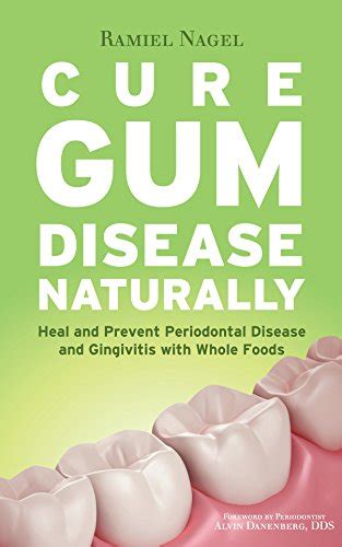 Read Online Cure Gum Disease Naturally Heal And Prevent Periodontal Disease And Gingivitis With Whole Foods By Ramiel Nagel