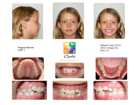 Curtis orthodontics. My experience at Curtis Orthodontics was outstanding! Dr Curtis and the team provided friendly personalized care, that was painless. The modern and welcoming environment, coupled with the advanced technology, showcased their commitment to top-notch orthodontic care. If you're looking for a practice that combines expertise with a personal … 