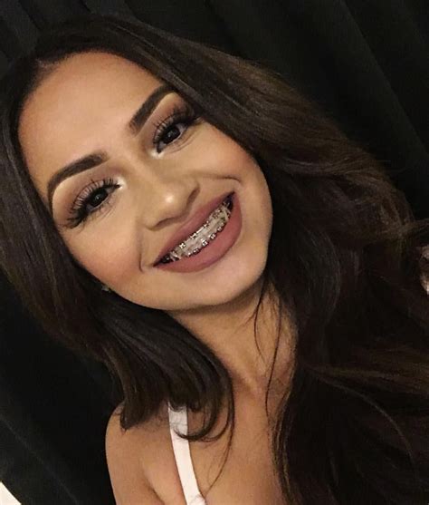 Cute latina with braces. Things To Know About Cute latina with braces. 