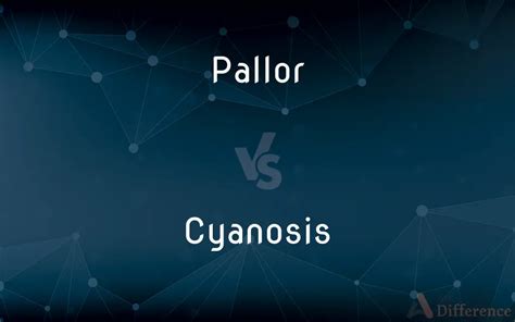 Cyanosis vs Pallor - What