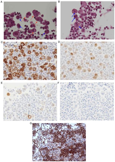 Cytologi undersökning