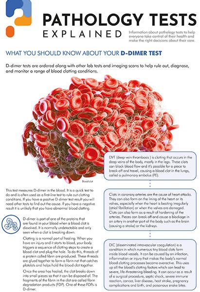 D-Dimer - North West London Pathology