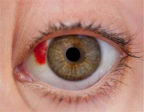 Darah Di Mata - muktibox.com