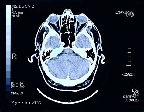 DICOM File What It Is and How to Open One 