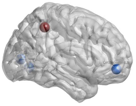 Differential analysis of brain functional network parameters in MHE ... - coolestguyplanet.net