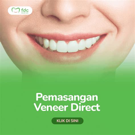 direct veneer harga - elchoricharrua.com