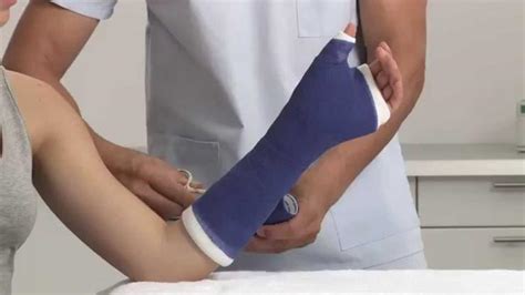 Discover the Difference: Fibreglass Casting Clinic vs. Traditional ... - muktibox.com