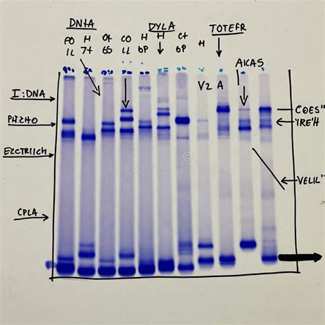 Dna Electrophoresis Gel Bands - wintechmobiles.com