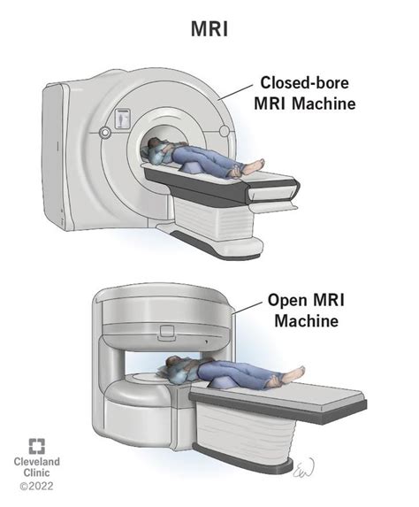 Does Er Do Mri - wintechmobiles.com