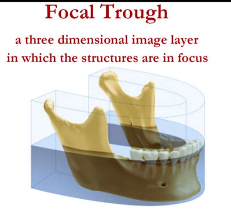 DR 2 - Panarex Imaging Flashcards Quizlet