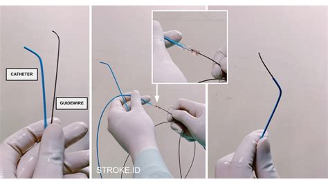 dsa saraf - elchoricharrua.com