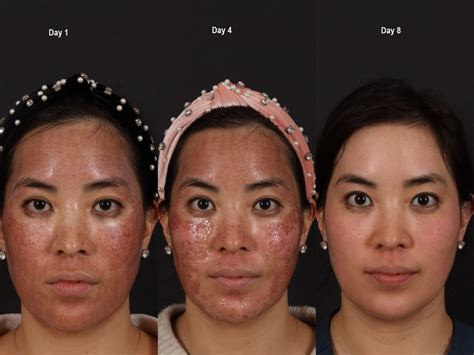 dual face - elchoricharrua.com