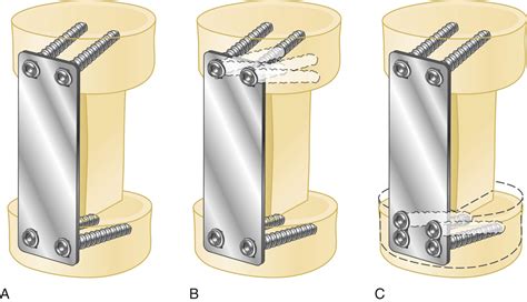 Dynamic Plates - muktibox.com