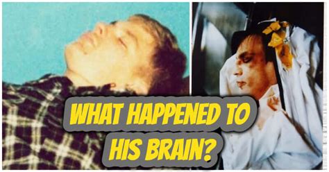 Dahmer's autopsy. Things To Know About Dahmer's autopsy. 