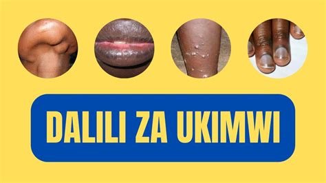 Dalili za ukimwi kwa mtoto mdogo pdf. .  <a href=https://testnnnn.on-forge.com/assets/images/p...