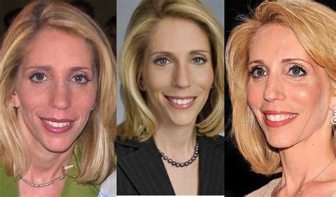 Dana Bash Plastic Surgery - Nose Job, Facelift, Body …