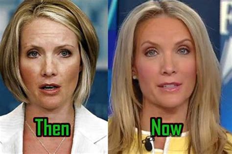 Dana perino plastic surgery. Aug 2, 2022 · Perino has posted multiple photos of her dog, Percy, to social media recently. Concerned fans have taken to social media wondering where Perino has been. "Is anyone else missing @DanaPerino? I’m hoping she’s not sick. It’s weird not having Dana on @AmericaNewsroom and @TheFive. Dana come back soon you’re greatly missed. 