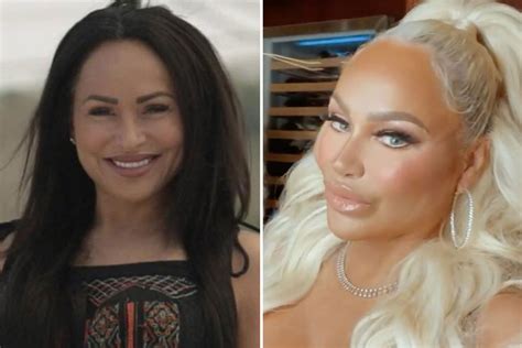 Stacey noted, "They get mad that we did all these surgeries and then they get new teeth and new hair and I'm like, there's nothing wrong with a glow up, like, geez." Darcey & Stacey airs Mondays .... 