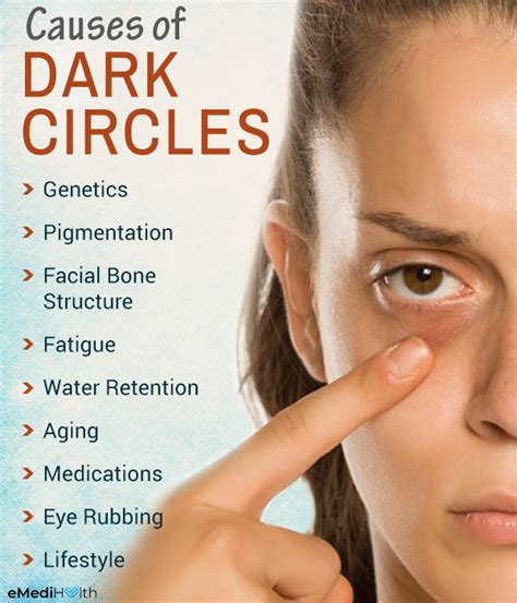 Dark Circles Under The Eyes: Causes And Treatment