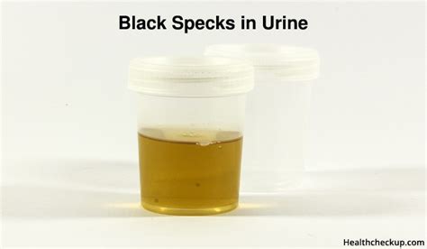 Dark specks in urine. 