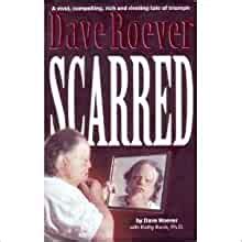 Scarred is a strong, energetic account of Dave Roever's life. He tells an explosive story of triumph. Reflecting on his youth, his injury in Vietnam, & his continuing recovery, you'll feel like you're there with Dave as his faith carries him through.
