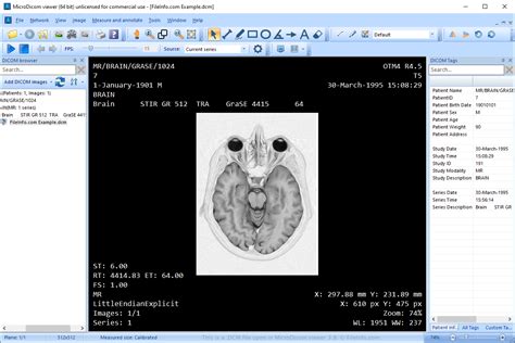 Weasis is a free medical image viewer software that lets you open DICOM files and images in other formats. To open a DICOM file, go to “File > Open > DICOM.”If you want to open the image files .... 