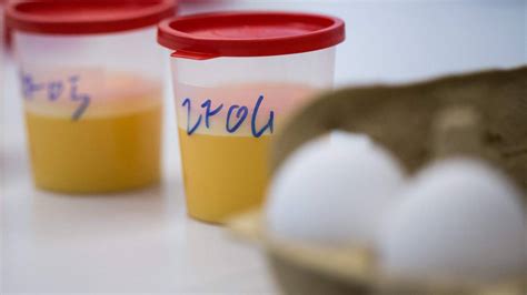 De vijf meest gestelde vragen over fipronil, en de antwoorden