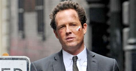 Dean Winters is an American actor that is best known for his role in “