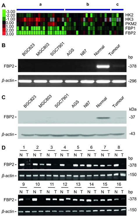 Decreased fructose-1,6-bisphosphatase-2 expression ... - Molecular Cancer